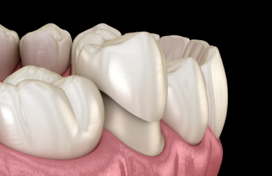 Close-up of realistic 3D-rendered teeth with gum tissue, highlighting dental anatomy relevant for a dentist's practice.