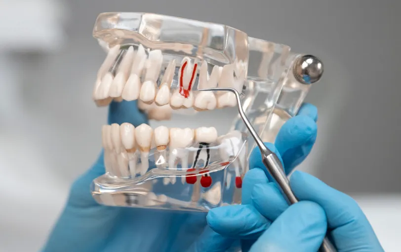A hand holding a dental tool is pointing at a clear model of teeth showing gum inflammation and cavities.