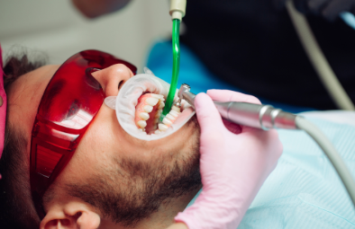 A dentist using a dental tool on a patient's teeth while the patient wears protective eyewear in a dental treatment room.