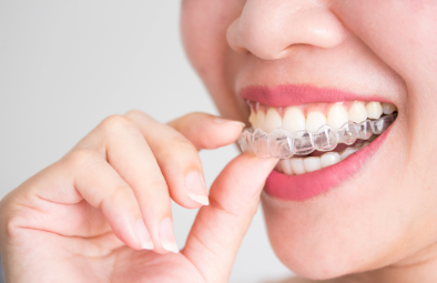 A person placing a clear dental aligner over their teeth, showcasing a smile with healthy teeth.